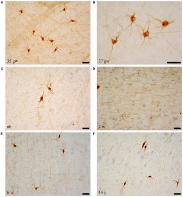 Postnatal Development of NPY and Somatostatin-28 Peptidergic Populations in the Human Angular Bundle